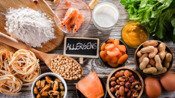 Managing Food Allergies with Limited Resources